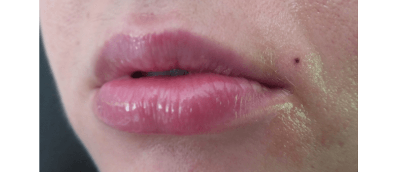 micropigmentación labios pinto